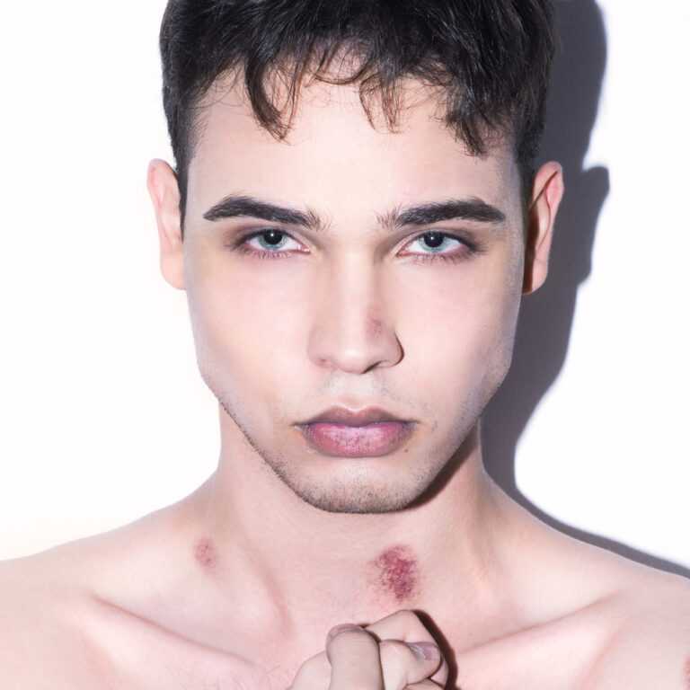 Male with hickey