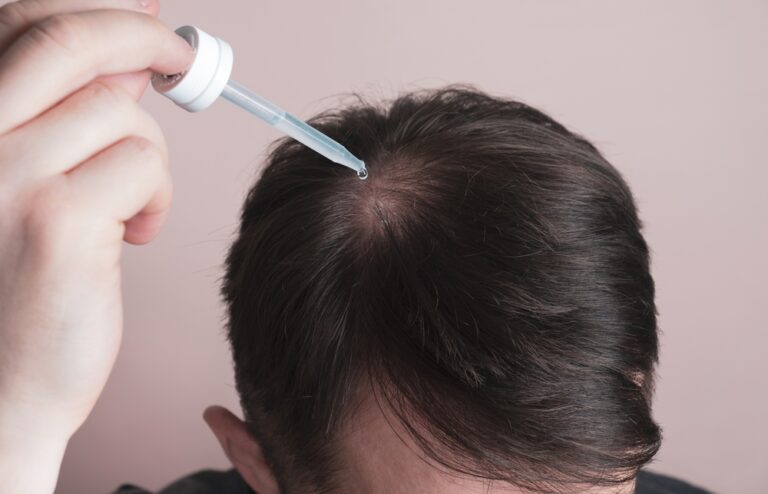 Man applying hair growth serum